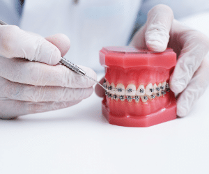 orthodontics-treatment-hyderabad-dentist